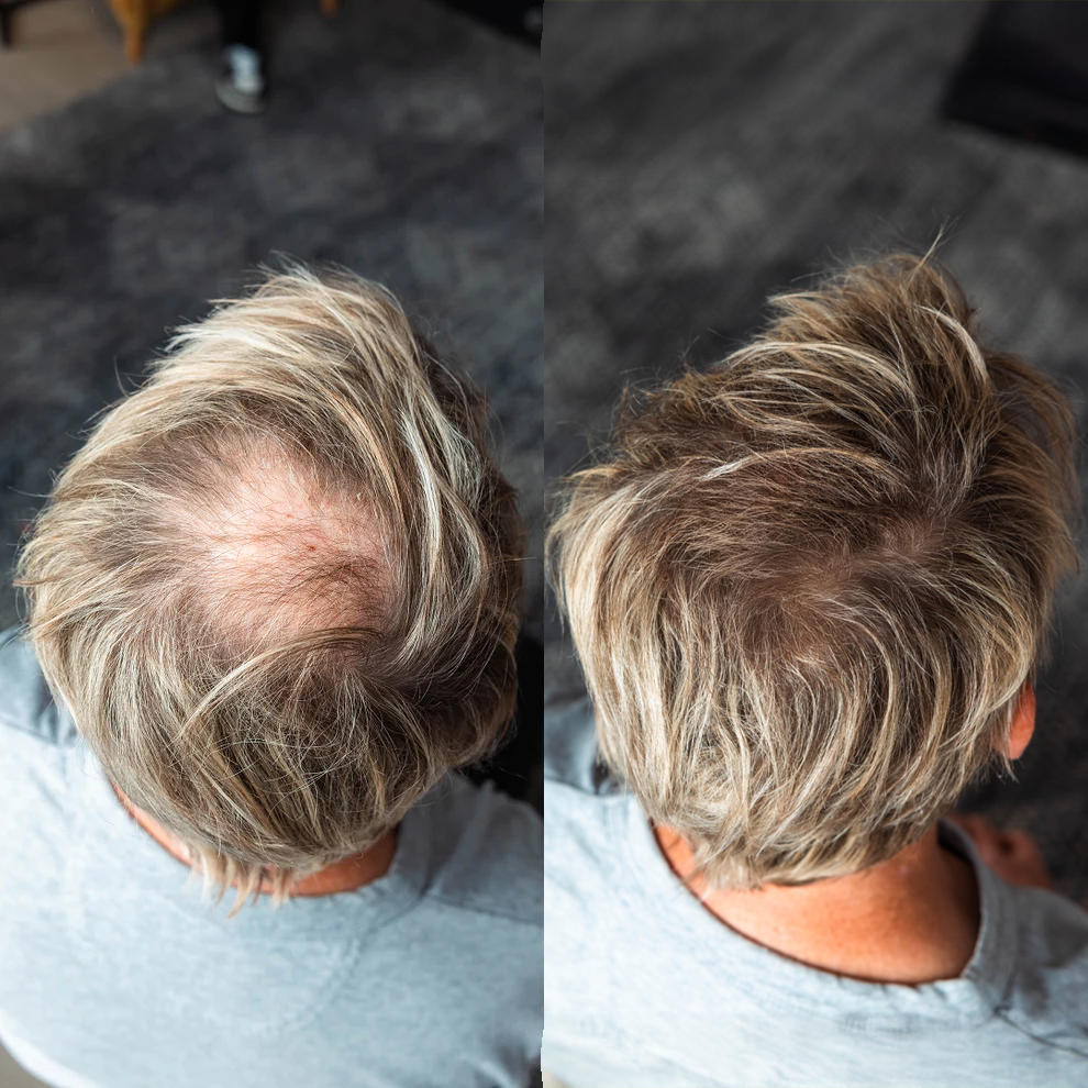 Hair Thickening Fibres